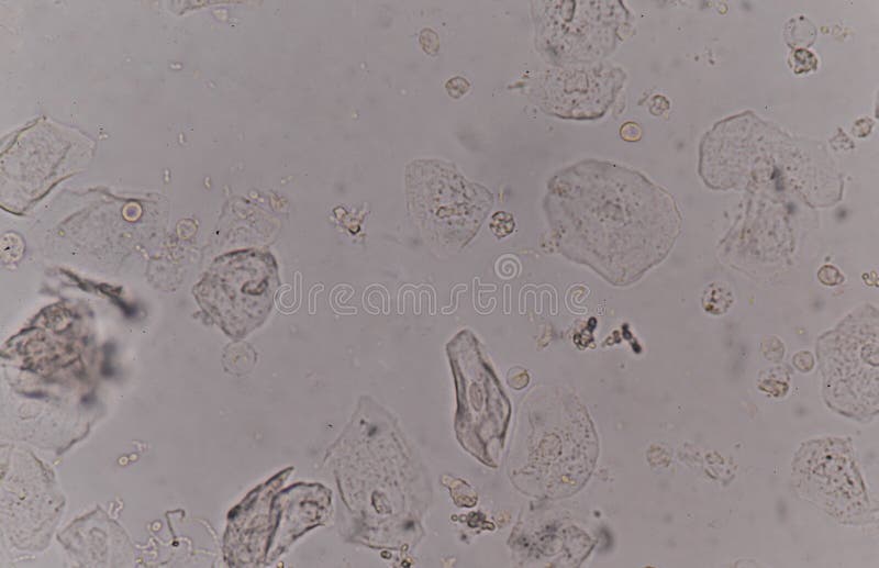 yeast cell diagram gcse