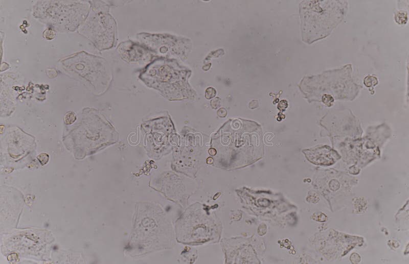 yeast cell diagram gcse