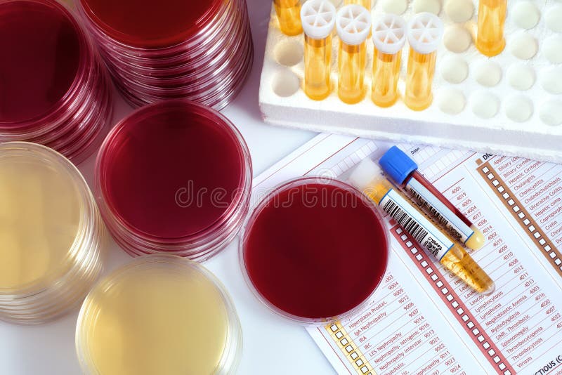 Equipamento médico com tubos da urina e pratos de petri para a análise foto de stock royalty free Equipamento médico com tubos da urina e pratos de petri para a análise foto de stock royalty free