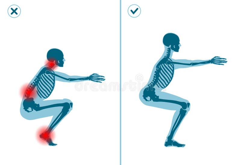 Wrong and correct air squat exercise. Right and wrong execution technique of sport gymnastics. Common mistakes in sport workout. Wrong and correct air squat exercise. Right and wrong execution technique of sport gymnastics. Common mistakes in sport workout.