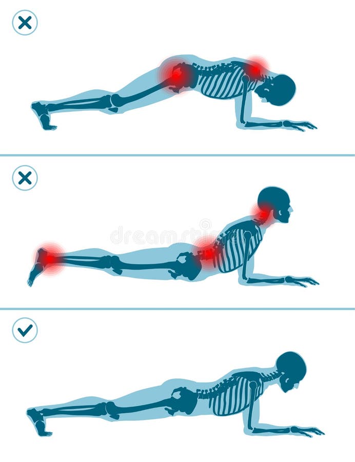 Wrong and correct plank position. Right and wrong execution technique of sport exercise. Common mistakes in sport workout. Man standing on elbows. Wrong and correct plank position. Right and wrong execution technique of sport exercise. Common mistakes in sport workout. Man standing on elbows.