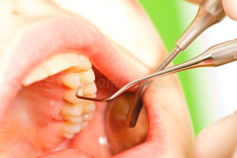 Esame dentale fotografia stock libera da diritti Esame dentale fotografia stock libera da diritti
