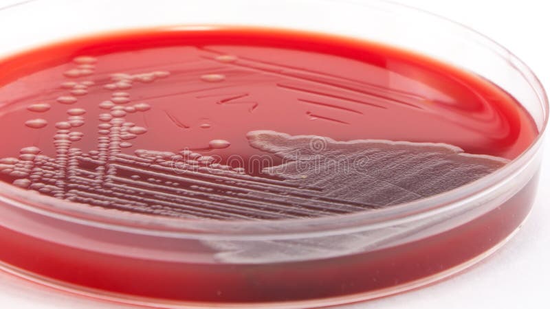 Escherichia Coli bacteria on columbia blood agar royalty free stock photography Escherichia Coli bacteria on columbia blood agar royalty free stock photography