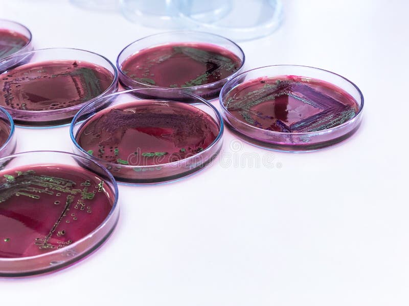 Escherichia coli E coli cultivé avec de l'Eosin Methylène Blue EMB Agar dans la boîte de Petri montre les colonies de feuilles mé