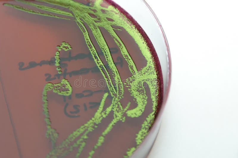 Escherichia coli sur l'agar d'EMB