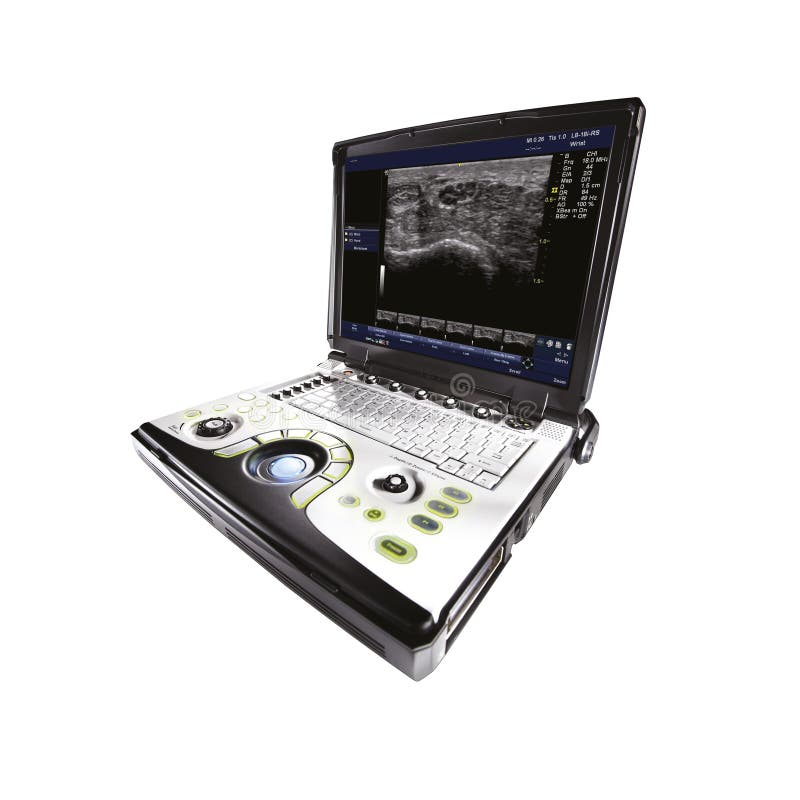Escáner universal del ultrasonido, aislado en el fondo blanco Equipamiento médico imágenes de archivo libres de regalías Escáner universal del ultrasonido, aislado en el fondo blanco Equipamiento médico imágenes de archivo libres de regalías