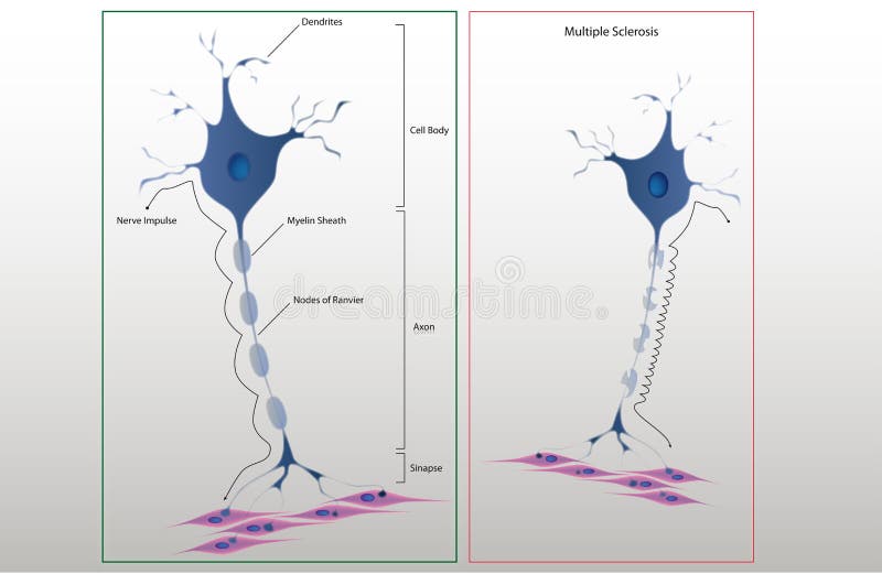 Estructura del esquema de una neurona típica