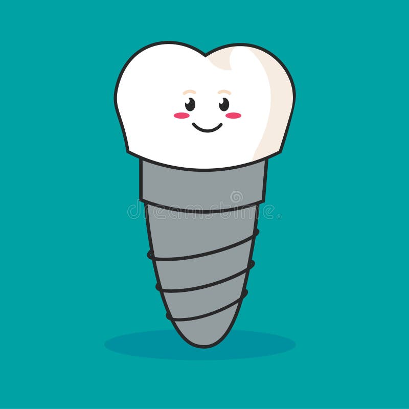 Estrutura do implante dental médica, dentes e conceito do dente de dental ilustração royalty free Estrutura do implante dental médica, dentes e conceito do dente de dental ilustração royalty free