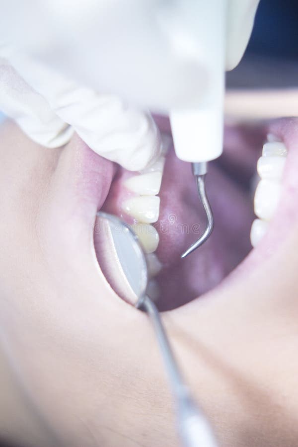 Examen dentaire de bouche patiente de dentiste photographie stock libre de droits Examen dentaire de bouche patiente de dentiste photographie stock libre de droits