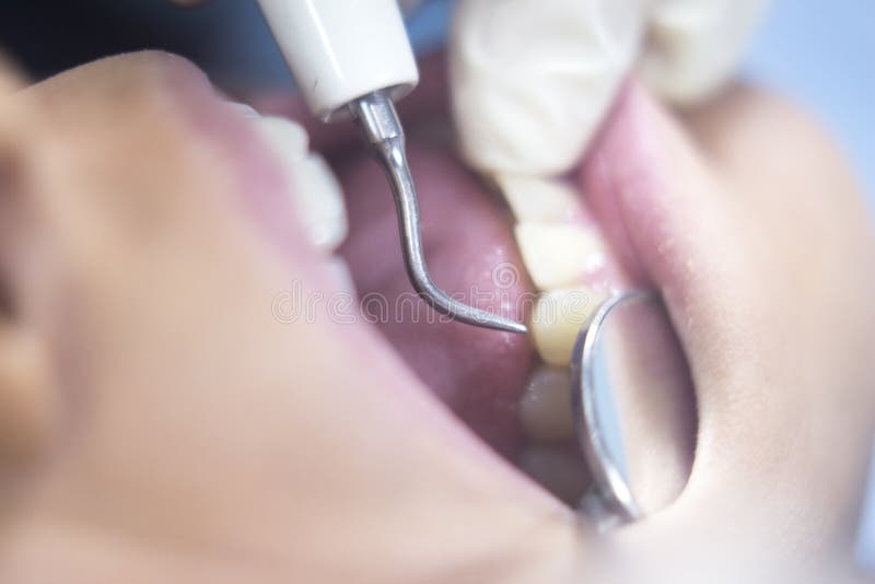 Examen dentaire de bouche patiente de dentiste photographie stock Examen dentaire de bouche patiente de dentiste photographie stock