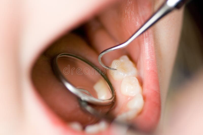 Examiner les dents d'un enfant photographie stock Examiner les dents d'un enfant photographie stock