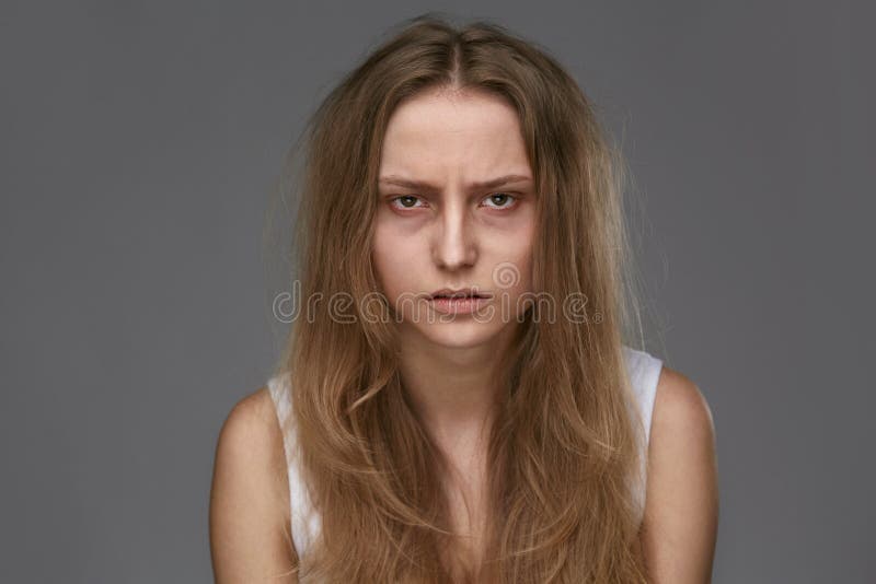 Girl naked with bruised and black skin 1 446 Bruises Photos Free Royalty Free Stock Photos From Dreamstime