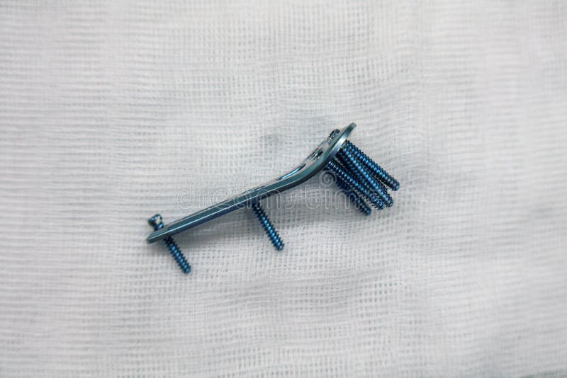 Explanted Surgical Blue Titanium Radius Plate Lies on a White Compress