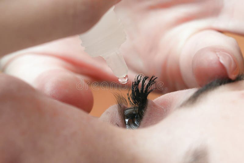 Eye Drops and Pollen Allergy Stock Photo Image of vision, therapy