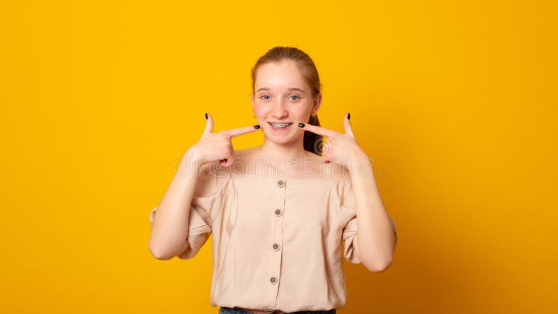 Face of a young smiling teen girl with braces on teeth, Orthodontic Treatment