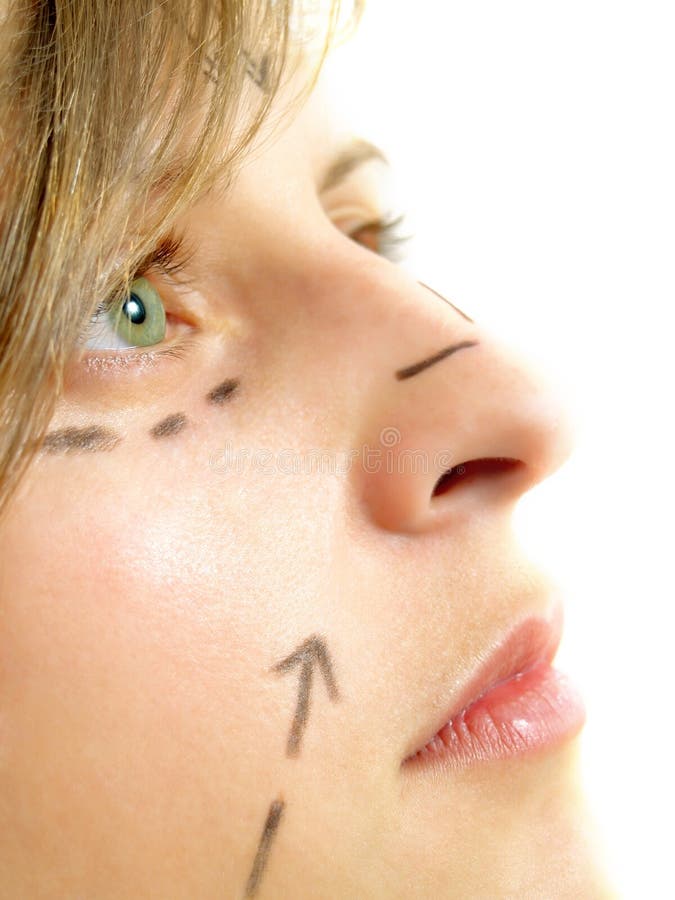 Closeup portrait of an attractive Caucasian girl whose face is marked with lines and arrows for facial cosmetic surgery. Isolated on white. Closeup portrait of an attractive Caucasian girl whose face is marked with lines and arrows for facial cosmetic surgery. Isolated on white.