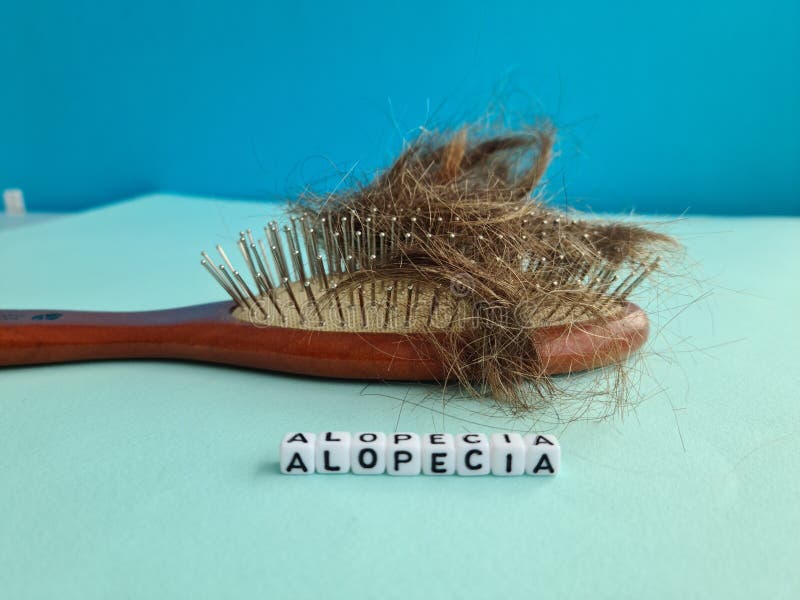 Fallen Hair Tangled in Comb. Hair Loss and Alopecia Stock Photo Image