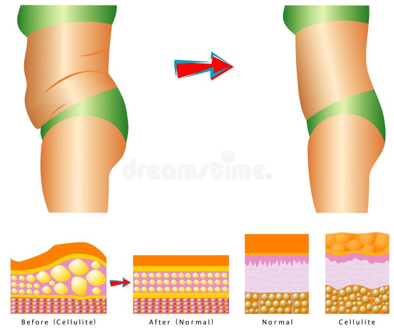 Fat on belly. royalty free illustration Fat on belly. royalty free illustration