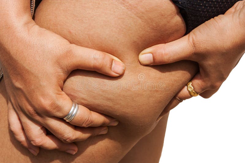 Fat thighs, cellulite royalty free stock photography Fat thighs, cellulite royalty free stock photography