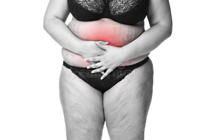 Fat woman with menstrual pain, endometriosis or cystitis, stomach ache, ove...