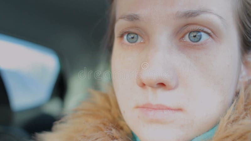 Menina De Scowling Que Aponta Para Sua Acne Com Uma Toalha Em Sua Cabeça.  Conceito Do Cuidado Da Pele Da Mulher, Fotos Da Menina Feia Da Pele Do  Problema No Fundo Branco