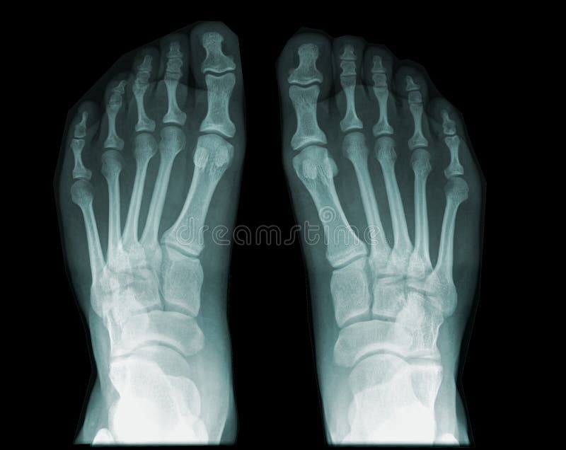 Feet from above royalty free illustration