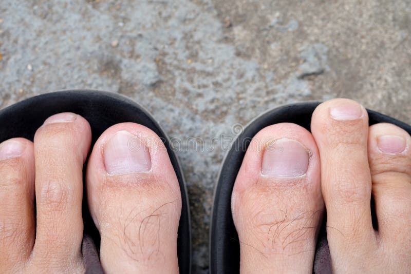 male feet in sandals