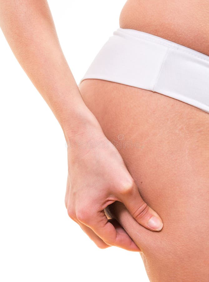 Close Up Woman Grabbing Skin On Her Flanks With The Drawing Black Arrows  Lose Weight And Liposuction Cellulite Removal Concept Isolated On White  Background Stock Photo - Download Image Now - iStock