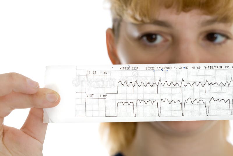 Female doctor with cardiogram