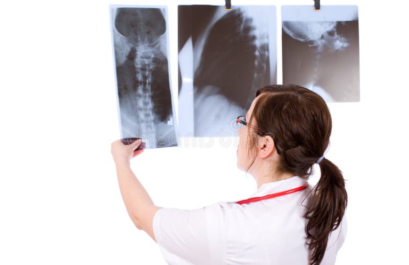 Female doctor isolated on white with 3 x-ray