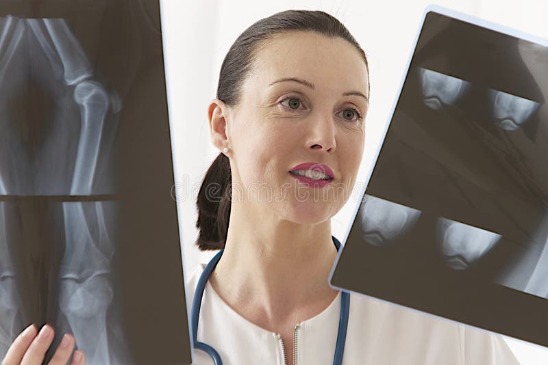 Female doctor looking to knee X-ray royalty free stock photos Female doctor looking to knee X-ray royalty free stock photos