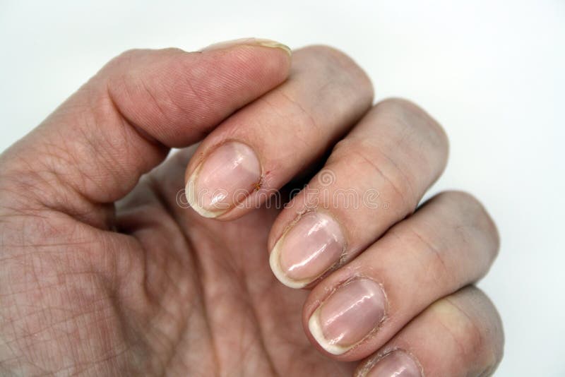 HOW TO STOP BITING YOUR NAILS | Gallery posted by Wurk | Lemon8