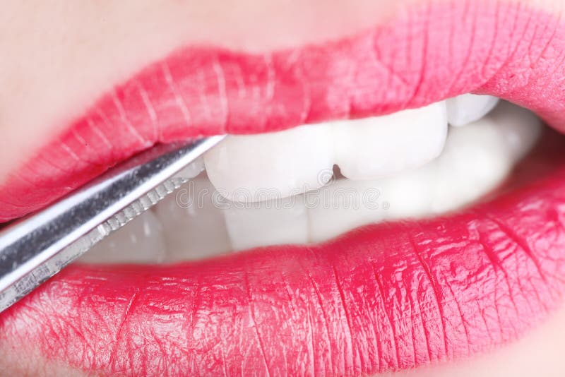 Female Lips with Surgery Tool Stock Photo Image of esthetic
