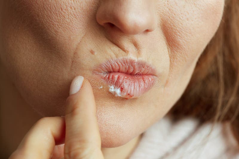 Femme appliquant un onguent avec doigt isolé sur beige photos stock