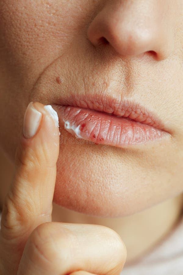 Femme de 40 ans appliquant des onguents en utilisant le doigt sur beige photographie stock
