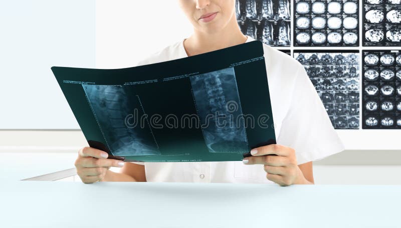 Femme de radiologue vérifiant le rayon X, soins de santé, concept médical image libre de droits Femme de radiologue vérifiant le rayon X, soins de santé, concept médical image libre de droits