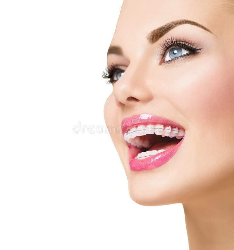 Femme souriant avec les accolades en céramique sur des dents image stock Femme souriant avec les accolades en céramique sur des dents image stock