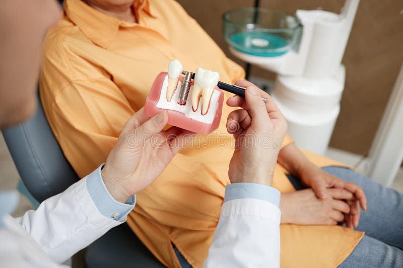 Dentiste Méconnaissable Mettant Un Rouleau De Coton Dentaire à L'aide De  Pinces Et D'un Miroir Buccal à Une Patiente. Photo stock - Image du  dentisterie, miroir: 247932370