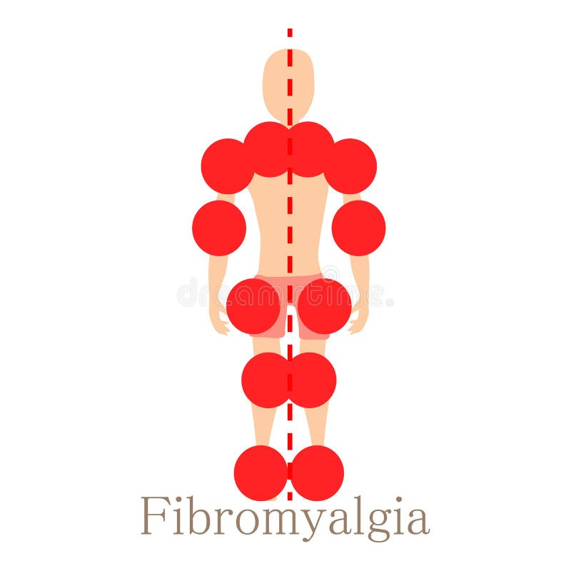 Fibromyalgiapictogram, beeldverhaalstijl stock illustratie Fibromyalgiapictogram, beeldverhaalstijl stock illustratie