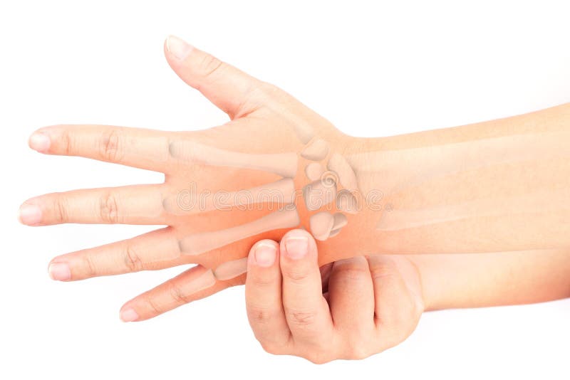 Finger bone pain stock photo. Image of illness, phalanges 78012330