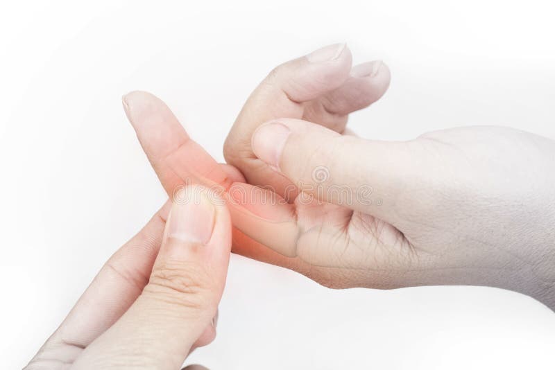 Finger bone pain stock photo. Image of calcium, bone 79794456