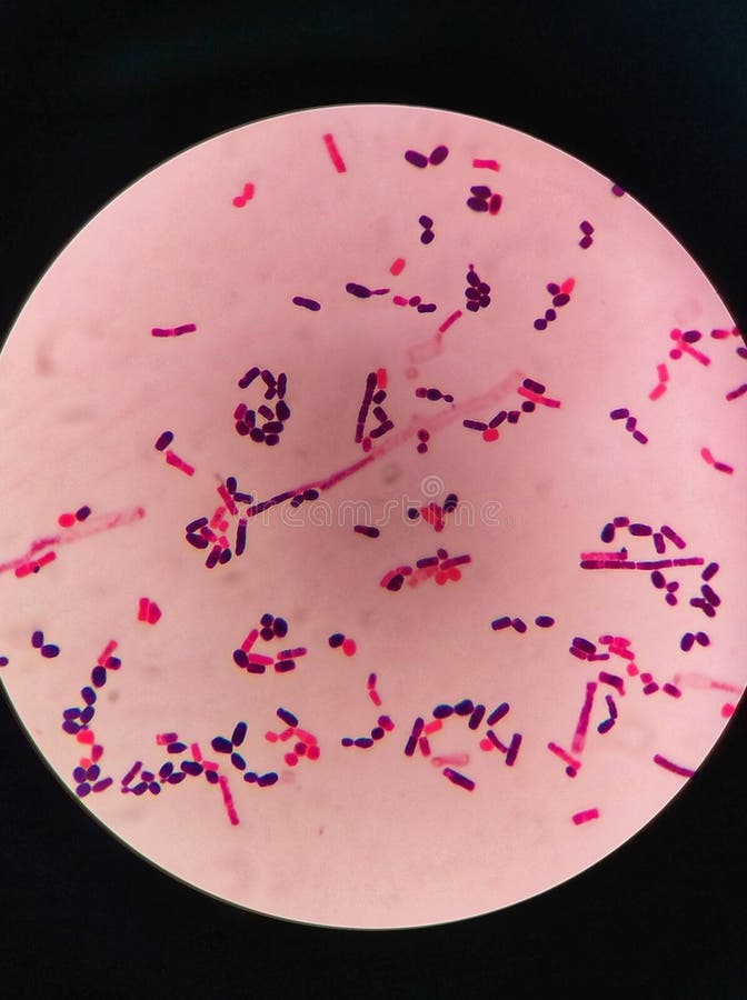 Yeast Cells and Hyphae in Gram Stain Fine with Microscope. Stock Image