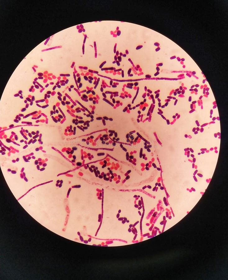 Yeast Cells and Hyphae in Gram Stain Fine with Microscope. Stock Image