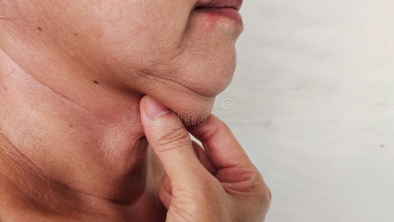 The flabbiness adipose sagging skin under the neck, rough skin and cellulite on the body, problem wrinkle and flabby skin under the chin, health care and beauty concept. Problem wrinkle stock images, royalty-free photos and pictures