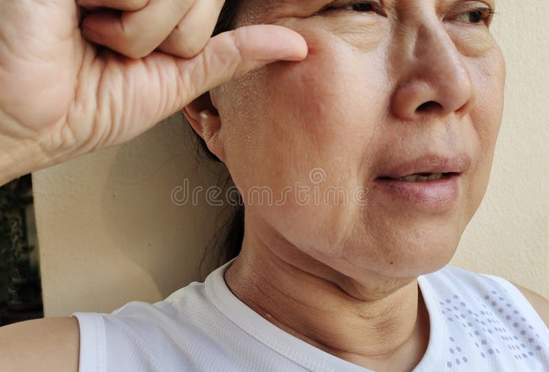 Portrait showing the flabbiness adipose sagging under the eyes, ptosis and swelling beside the eyelids, forehead lines and freckles on the face, melasma and blemish, problem wrinkle and dullness of the woman, health care and beauty concept. Problem wrinkle stock images, royalty-free photos and pictures