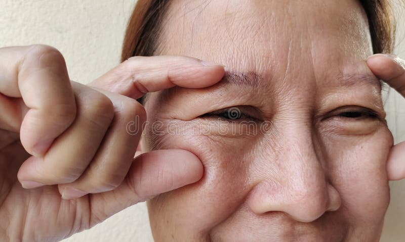 Portrait showing the flabbiness adipose sagging under the eye, ptosis and swelling beside the eyelid, forehead lines and freckles on the face, cellulite and bag under the eye, problem wrinkle and dullness of the woman, health care and beauty concept. Problem wrinkle stock images, royalty-free photos and pictures