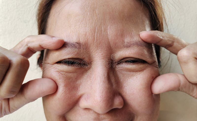 Portrait showing the flabbiness adipose sagging under the eyes, ptosis and swelling beside the eyelids, forehead lines and freckles on the face, cellulite and bag under the eyes, problem wrinkle and dullness of the woman, health care and beauty concept. Problem wrinkle stock images, royalty-free photos and pictures