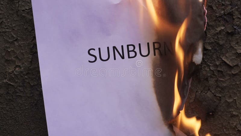 Flaming word sunburn