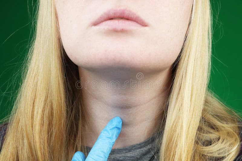 Flickan på undersökning på doktorn thyroid royaltyfri foto Flickan på undersökning på doktorn thyroid royaltyfri foto