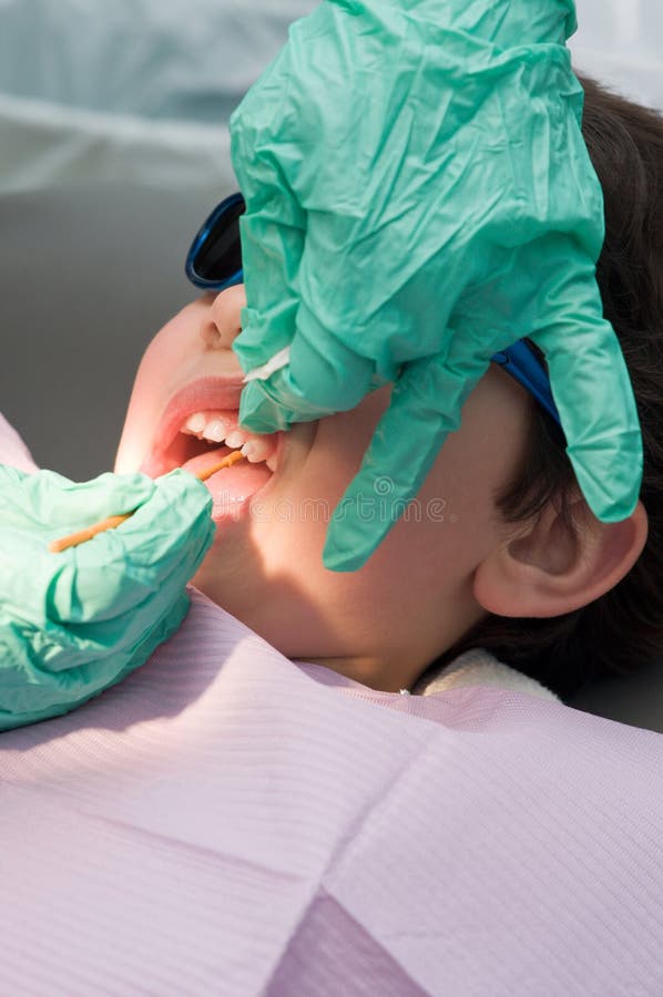 fluoruro del dentista del ragazzo di applicazione che ha fotografie stock fluoruro del dentista del ragazzo di applicazione che ha fotografie stock